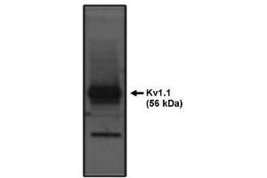 Image no. 1 for anti-Potassium Voltage-Gated Channel, Shaker-Related Subfamily, Member 1 (KCNA1) antibody (ABIN265021)