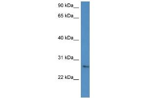 WB Suggested Anti-CMA1 Antibody Titration: 0.