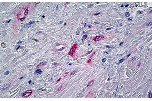 Human Prostate, Stroma: Formalin-Fixed, Paraffin-Embedded (FFPE) (PPP1R13L antibody  (AA 75-125))