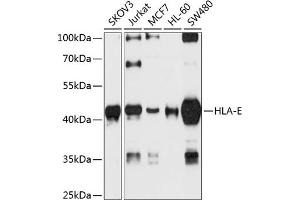 Western blot analysis of extracts of various cell lines, using HLA-E antibody (ABIN6133750, ABIN6141843, ABIN6141845 and ABIN6224489) at 1:1000 dilution. (HLA-E antibody  (AA 1-100))