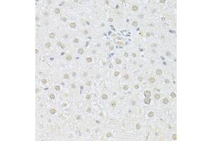 Immunohistochemistry of paraffin-embedded rat liver using AKT1 antibody (ABIN5997218) at dilution of 1/100 (40x lens). (AKT1 antibody)