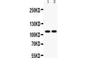 Anti- ATP2A1 antibody, Western blotting All lanes: Anti ATP2A1  at 0. (ATP2A1/SERCA1 antibody  (N-Term))