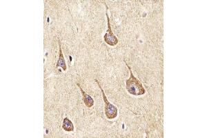 (ABIN6242948 and ABIN6577962) staining NPY2R in Human brain tissue sections by Immunohistochemistry (IHC-P - paraformaldehyde-fixed, paraffin-embedded sections). (NPY2R antibody  (N-Term))