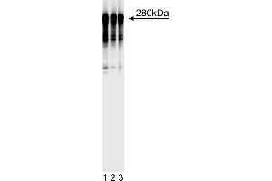 Western Blotting (WB) image for anti-Microtubule-Associated Protein 2 (MAP2) antibody (ABIN967494) (MAP2 antibody)