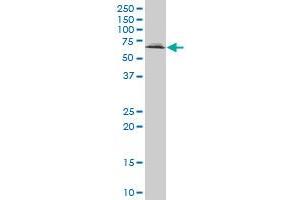 UBQLN2 polyclonal antibody (A01), Lot # 061101JCS1 Western Blot analysis of UBQLN2 expression in Jurkat . (Ubiquilin 2 antibody  (AA 555-624))