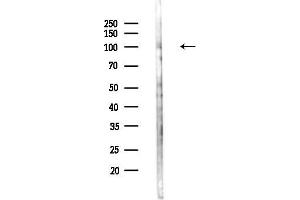 anti-rho GTPase Activating Protein 12 (ARHGAP12) (Internal Region) antibody