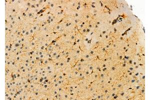 ABIN6263816 and ABIN6276336 at 1/100 staining Mouse brain tissue by IHC-P. (Olfactomedin 1 antibody  (Internal Region))
