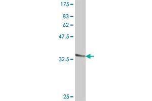 SLC25A18 antibody  (AA 124-184)