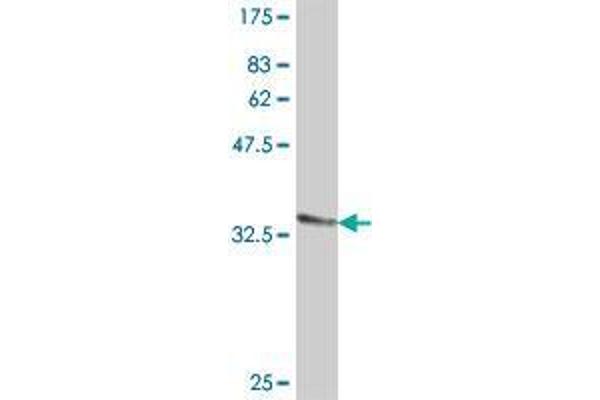 SLC25A18 antibody  (AA 124-184)