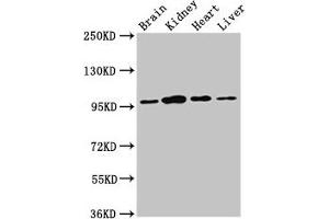 Western Blot Positive WB detected in: Rat brain tissue, Rat kidney tissue, Mouse heart tissue, Mouse liver tissue All lanes: NAA15 antibody at 3 μg/mL Secondary Goat polyclonal to rabbit IgG at 1/50000 dilution Predicted band size: 102, 62 kDa Observed band size: 95 kDa (NAA15 antibody  (AA 742-865))