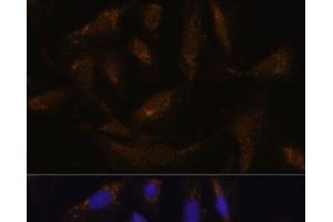 Immunofluorescence analysis of U-2 OS cells using SLC25A27 Polyclonal Antibody at dilution of 1:100. (SLC25A27 antibody)