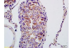 Formalin-fixed and paraffin embedded rat testis labeled with Anti phospho-PDHA1(Ser293) Polyclonal Antibody (ABIN752878), Unconjugated at 1:200, followed by conjugation to the secondary antibody and DAB staining (PDHA1 antibody  (pSer293))