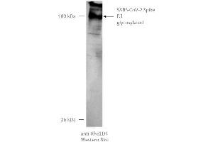 Western Blotting (WB) image for SARS-CoV-2 Spike (P.1 - gamma) protein (rho-1D4 tag) (ABIN6964443)