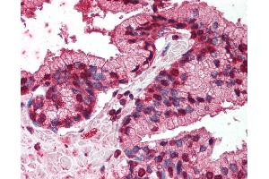 Anti-TNFRSF19 / TROY antibody IHC of human prostate. (TNFRSF19 antibody  (AA 29-44))