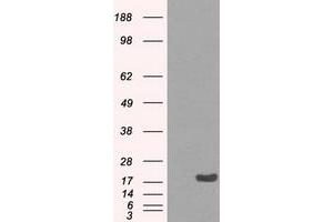 Image no. 2 for anti-Crystallin, alpha B (CRYAB) antibody (ABIN1497641) (CRYAB antibody)