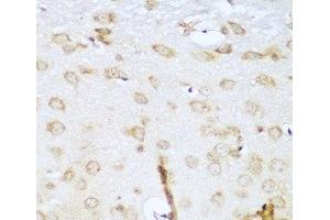 Immunohistochemistry of paraffin-embedded Mouse brain using UBE2L3 Polyclonal Antibody at dilution of 1:100 (40x lens).