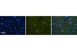Rabbit Anti-GREB1 Antibody    Formalin Fixed Paraffin Embedded Tissue: Human Adult heart  Observed Staining: Membrane Primary Antibody Concentration: 1:600 Secondary Antibody: Donkey anti-Rabbit-Cy2/3 Secondary Antibody Concentration: 1:200 Magnification: 20X Exposure Time: 0.