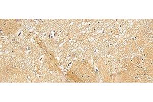 Immunohistochemistry of paraffin-embedded Human brain tissue using TXNDC12 Polyclonal Antibody at dilution of 1:50(x200) (TXNDC12 antibody)