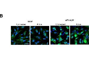 Silencing PLAUR affects proteins involved in DNA metabolism, synthesis and repair(A) Gene interacting networks generated using IPA showing the interacting genes and biological processes involving metabolism and incorporation of nucleotides, (B) MDA-MB-231 cells silenced for PLAUR were irradiated at 9 Gy, after 6 h cells were fixed and stained for 8-OHdG antibody. (8-OHDG antibody)