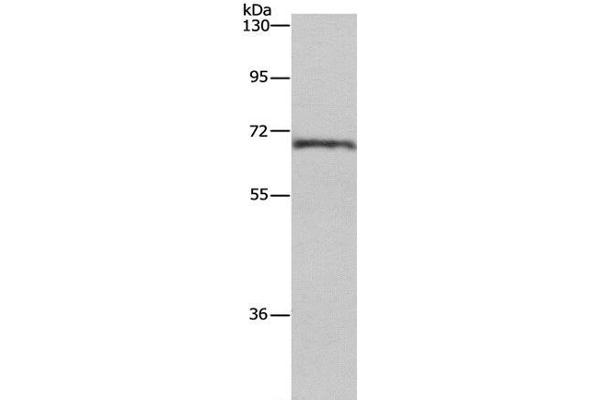 CDK5RAP3 anticorps