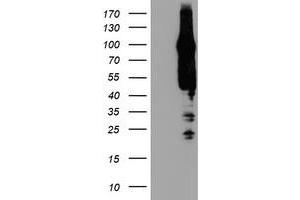 Western Blotting (WB) image for anti-ArfGAP with GTPase Domain, Ankyrin Repeat and PH Domain 1 (AGAP1) antibody (ABIN1497475)