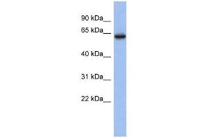 CACNB2 antibody used at 1 ug/ml to detect target protein. (CACNB2 antibody  (Middle Region))
