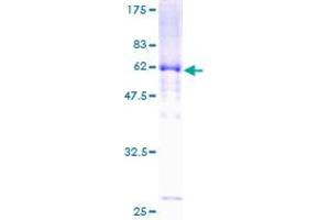 Image no. 1 for Dystrobrevin alpha (DTNA) (AA 1-371) protein (GST tag) (ABIN1352056) (DTNA Protein (AA 1-371) (GST tag))