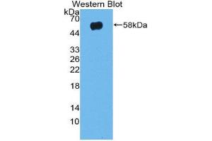 Western Blotting (WB) image for anti-Taxilin alpha (TXLNA) (AA 1-234) antibody (ABIN1980518) (alpha Taxilin antibody  (AA 1-234))