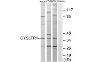 Western blot analysis of extracts from COLO205/HT-29/HeLa cells, using CYSLTR1 Antibody. (CysLTR1 antibody  (AA 131-180))