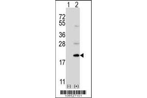 Western blot analysis of Ufc1 using rabbit polyclonal Ufc1 Antibody using 293 cell lysates (2 ug/lane) either nontransfected (Lane 1) or transiently transfected (Lane 2) with the Ufc1 gene. (UFC1 antibody  (C-Term))