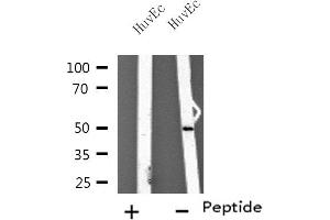 Western blot analysis of extracts from HuvEc cells using TUBA3C/E antibody. (TUBA3C/E antibody)