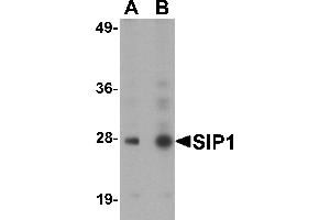 Western Blotting (WB) image for anti-Gem (Nuclear Organelle) Associated Protein 2 (GEMIN2) (C-Term) antibody (ABIN1030662) (SIP1 antibody  (C-Term))