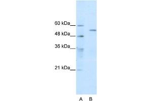 WB Suggested Anti-TRIM35 Antibody Titration:  0. (TRIM35 antibody  (C-Term))