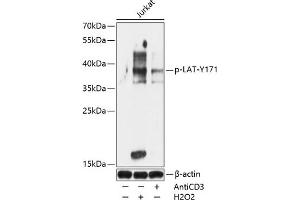 Western blot analysis of extracts of Jurkat cells, using Phospho-LAT-Y171 antibody (ABIN7268273) at 1:1000 dilution. (LAT antibody  (pTyr171))