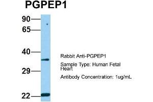 Host: Rabbit  Target Name: PGPEP1  Sample Tissue: Human Fetal Heart  Antibody Dilution: 1.