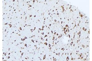 ABIN6276418 at 1/100 staining Mouse brain tissue by IHC-P. (Caspase 1 antibody  (C-Term))