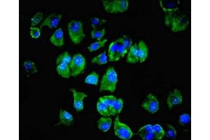 Immunofluorescent analysis of MCF-7 cells using ABIN7174192 at dilution of 1:100 and Alexa Fluor 488-congugated AffiniPure Goat Anti-Rabbit IgG(H+L) (LSM4 antibody  (AA 1-139))