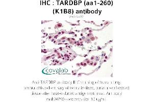 Image no. 3 for anti-TAR DNA Binding Protein (TARDBP) (AA 1-260) antibody (ABIN1723216) (TARDBP antibody  (AA 1-260))