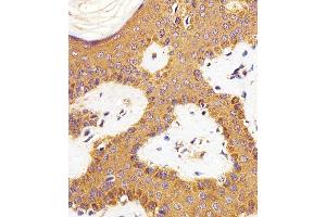 Paraformaldehyde-fixed, paraffin embedded human skin tissue, Antigen retrieval by boiling in sodium citrate buffer (pH6. (RAC1 antibody)