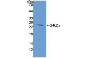 Figure. (TIM3 antibody  (AA 22-202))
