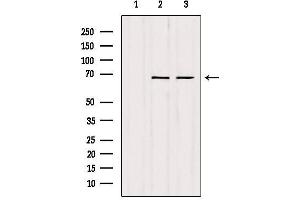 Western blot analysis of extracts from various samples, using SENP2 Antibody. (SENP2 antibody)