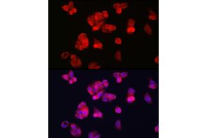 Immunofluorescence analysis of HepG2 cells using TFR2 Rabbit pAb (ABIN6128863, ABIN6149063, ABIN6149064 and ABIN6225172) at dilution of 1:100 (40x lens). (Transferrin Receptor 2 antibody  (AA 582-801))