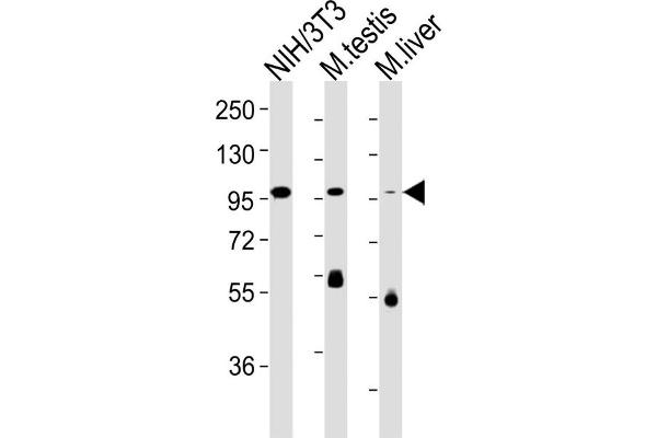 FER antibody