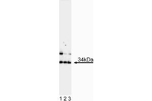 Western blot analysis of MASH1. (ASCL1 antibody)