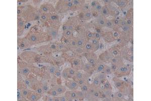 Used in DAB staining on fromalin fixed paraffin- embedded liver tissue (PPFIA1 antibody  (AA 1-250))
