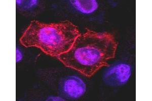 Immunocytochemistry staining (confocal microscopy) of HeLa human cervix carcinoma cell line transfected with TRAIL-R1 expression plasmid using anti-human TRAIL-R1 (DR-4-02). (TNFRSF10A antibody)