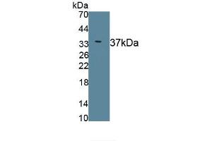 Detection of Recombinant ERLIN2, Human using Monoclonal Antibody to Endoplasmic Reticulum Lipid Raft Associated Protein 2 (ERLIN2) (ERLIN2 antibody  (AA 47-339))