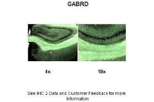 Sample Type :  Rat brain section  Primary Antibody Dilution :  1:1000  Secondary Antibody :  Anti-rabbit-biotin, streptavidin-diaminobenzidine  Secondary Antibody Dilution :  1:500  Gene Name :  GABRD  Submitted by :  Dr. (GABRD antibody  (N-Term))