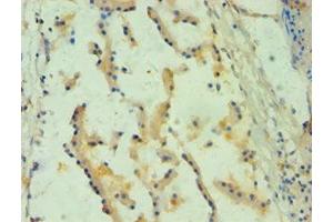 Immunohistochemistry of paraffin-embedded human prostate tissue using ABIN7157738 at dilution of 1:100 (SPINT1 antibody  (AA 250-529))