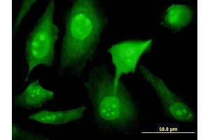 Immunofluorescence of monoclonal antibody to YY1AP1 on HeLa cell. (YY1AP1 antibody  (AA 1-739))